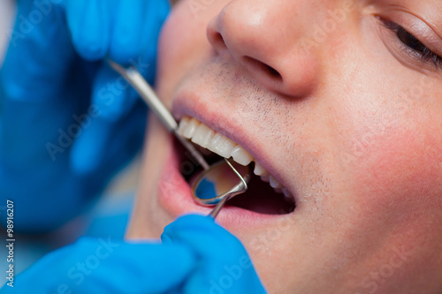 Dentist treatment a patient's teeth in the dentist.