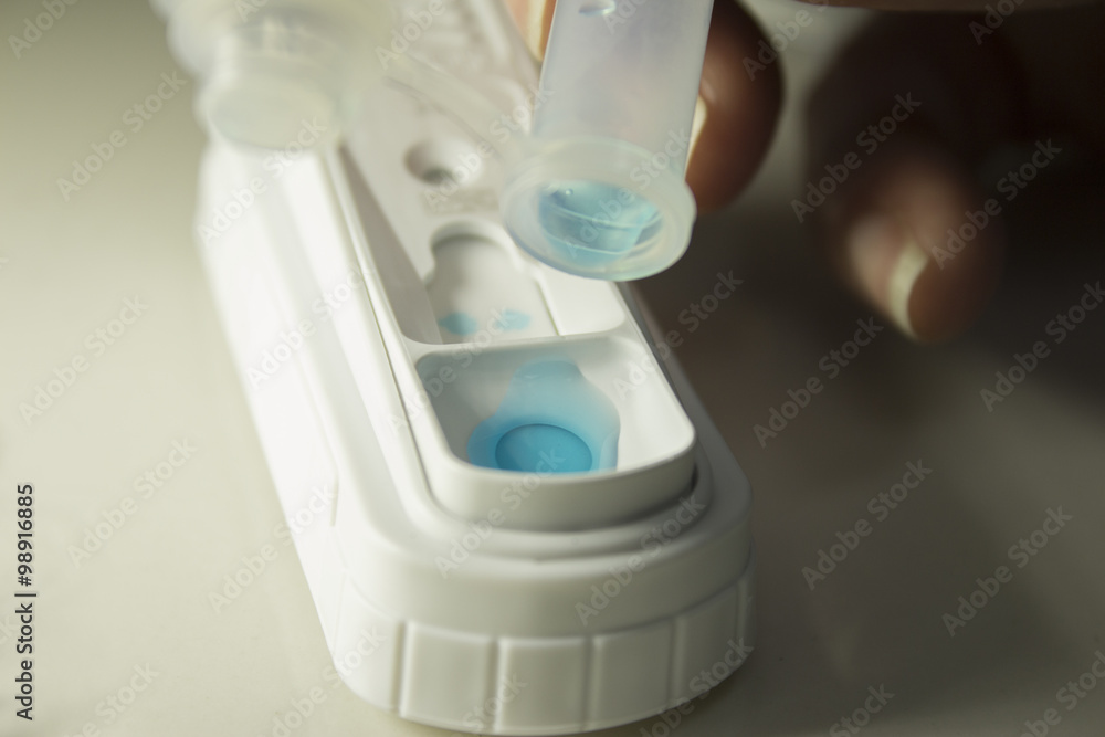 Test for internal parasites in pets Test for internal parasites in pets
