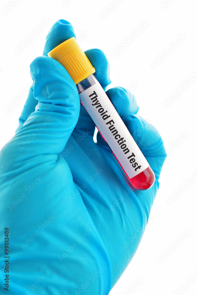 Obraz premium Thyroid function test