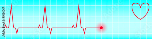 vector cardiogram