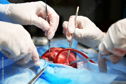 Fotografie, Obraz Doctor doing heart operation