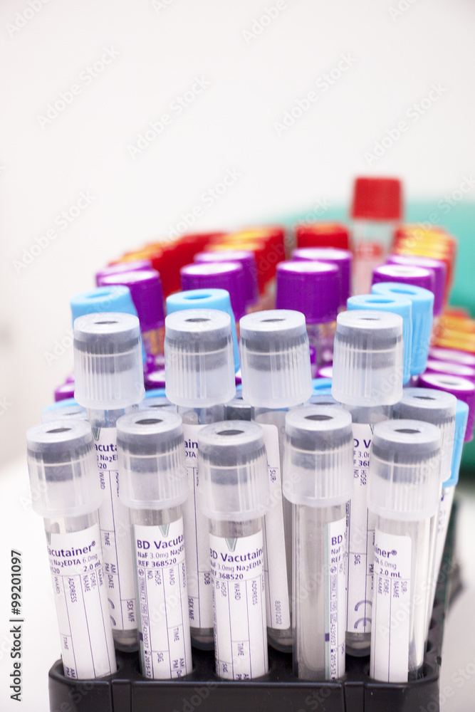 laboratory tubes for blood sampling laboratory tubes for blood sampling