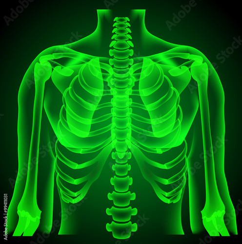  surgeon radiologist medical examaning lung torso  x-ray photo