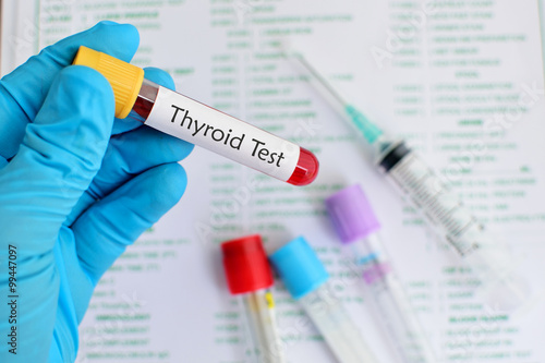 Thyroid test photo