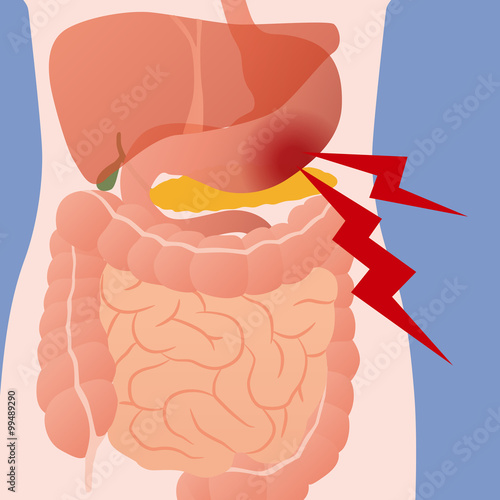 stomach ache and human digestive organs, vector illustration