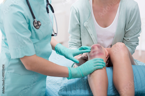Woman with bruised knee