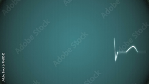 Abstract Heart Beat Cardiogram on Green Background. Animated Seamless Looping Motion Design. 4K & HD Footage Clip.