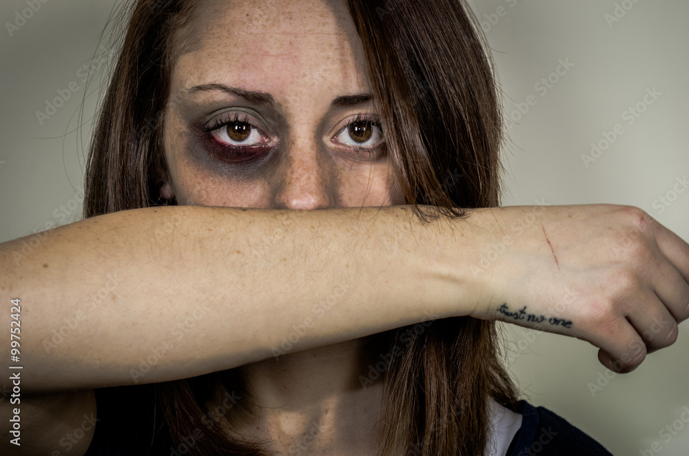 Sad beaten up girl with wounds on the face looking at the camera with deep  look - caucasian people - concept about violence against women Stock-Foto |  Adobe Stock