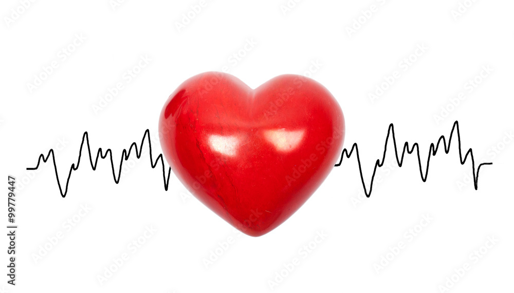 EKG - Herzuntersuchung