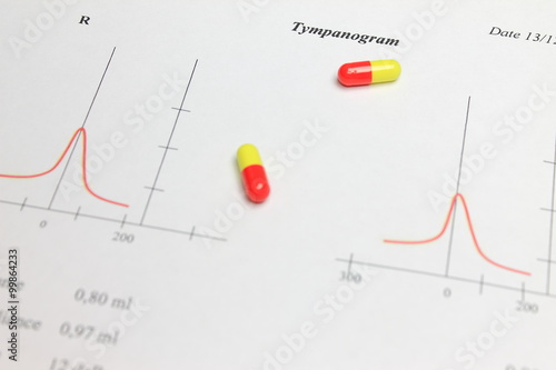 Pills and the results of tympanogram and audiometry 