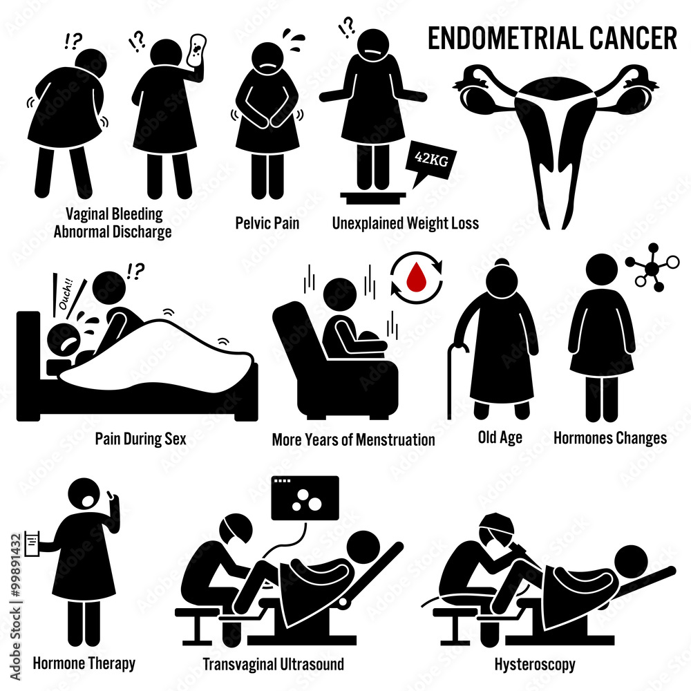 Endometrial cancer Information