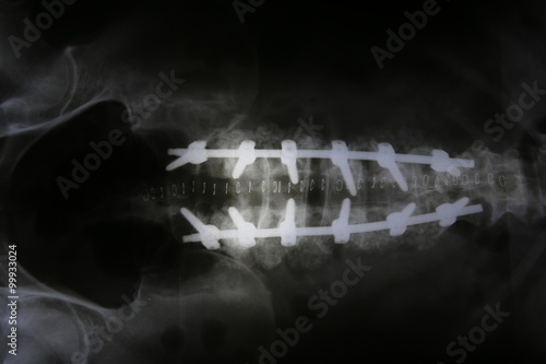 Film x-ray