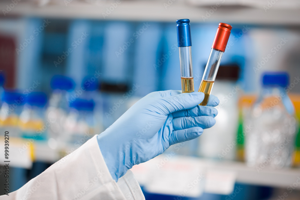 Landscape shot, Choice, victory, two vials Landscape shot, Choice, victory, two vials