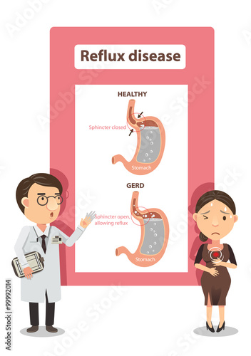 Acid Reflux