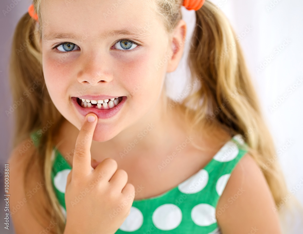 Little girl with falling tooth Little girl with falling tooth