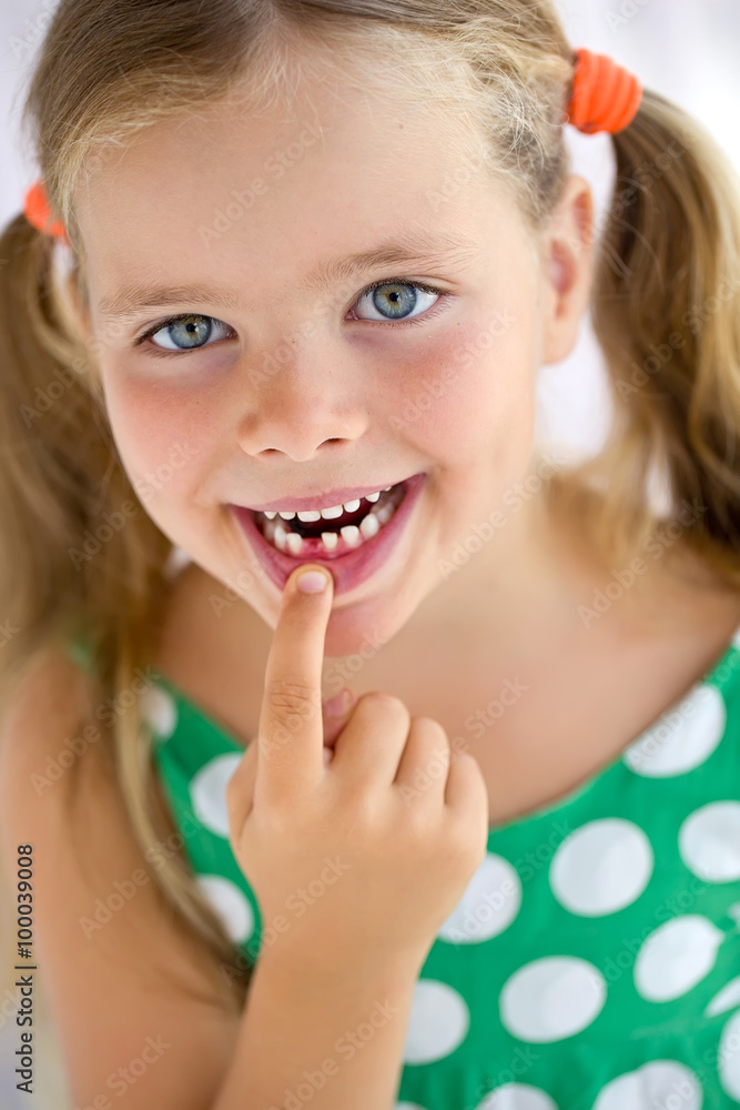 Little girl with falling tooth Little girl with falling tooth