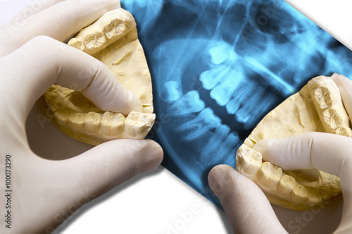 hands show molar teeth over x-ray dental scan
