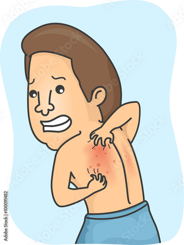 Man Scratching Back Rashes