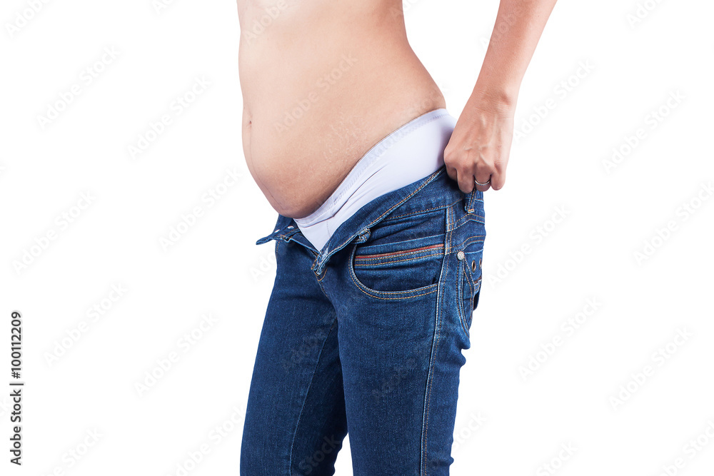 Women body fat belly and scratch mark Photos | Adobe Stock