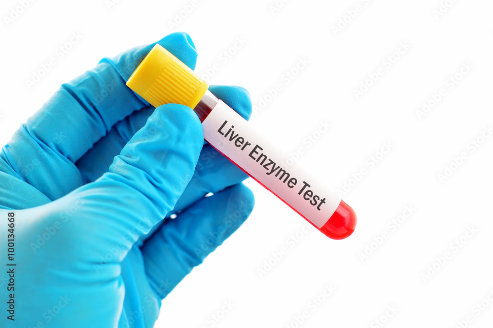 Fototapeta premium Blood for liver enzyme test