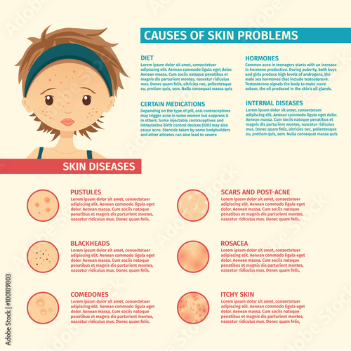 Infographics of skin problems, the causes of problem skin, types of problems. Girl with acne, pores, scars, pustules.