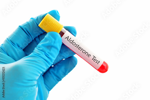 Aldosterone hormone test photo