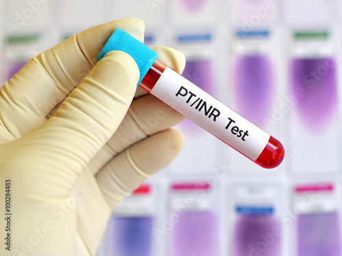 Obraz na plátne Blood sample for PT/INR test (Blood coagulation testing)