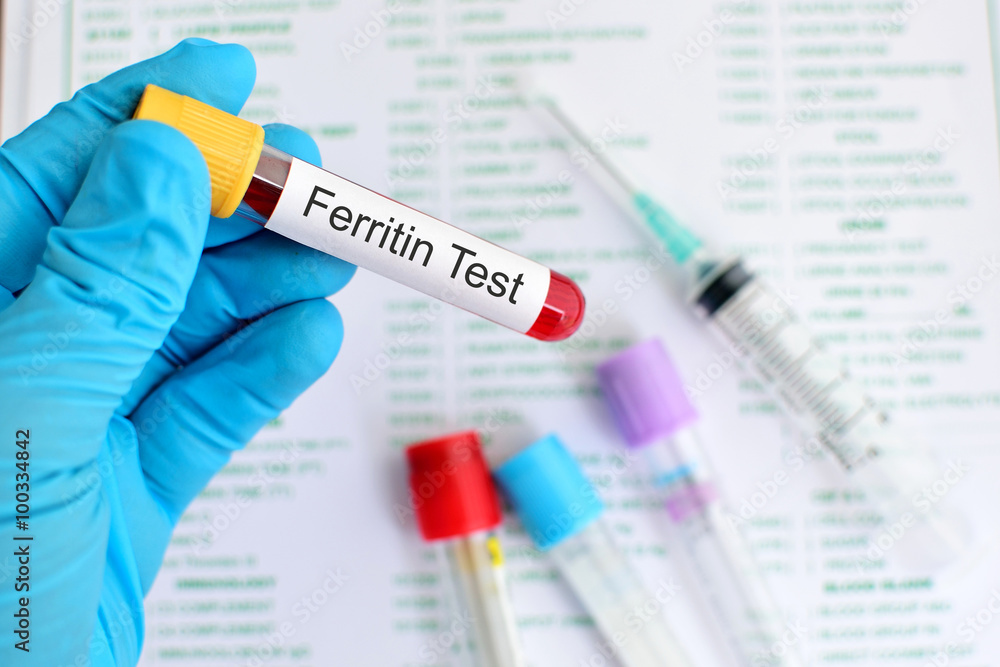 Ferritin test Ferritin test