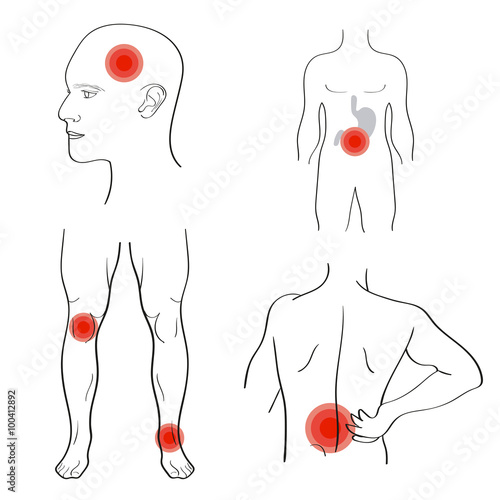 Set of people with pain dots. Headache, stomach-ache, backache.