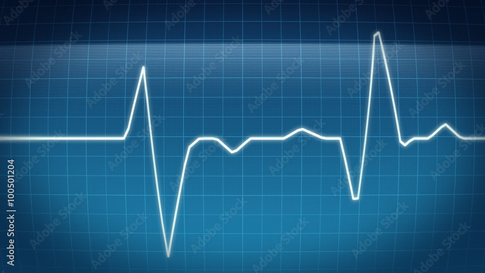 waveform monitor, Heartbeat ECG, pulse wave, loopable waveform monitor, Heartbeat ECG, pulse wave, loopable
