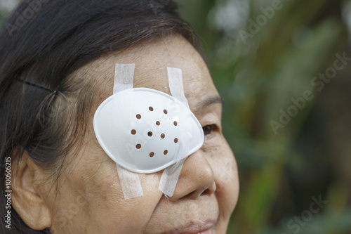 Fototapeta Naklejka Na Ścianę i Meble -  Elderly use eye shield covering after cataract surgery.