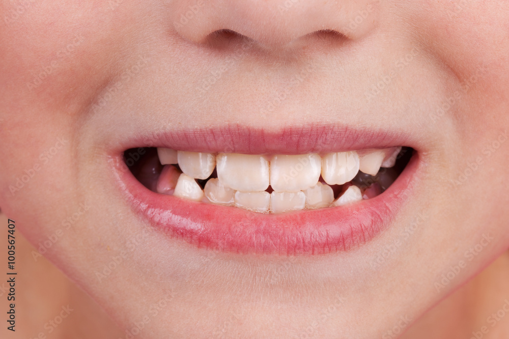 Obraz premium Face of a child with an open mouth and teeth