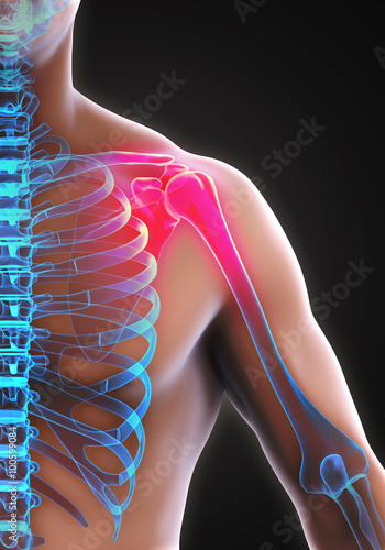 Painful Shoulder Illustration photo