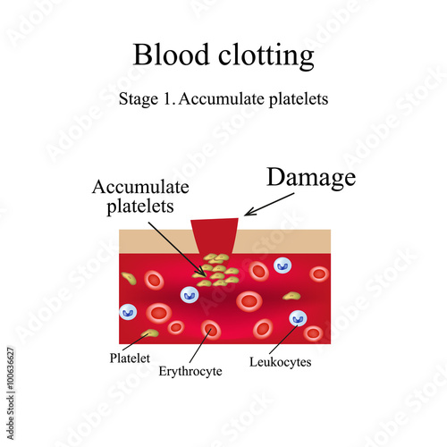 Blood clotting. Stage 1. Infographics. Vector illustration