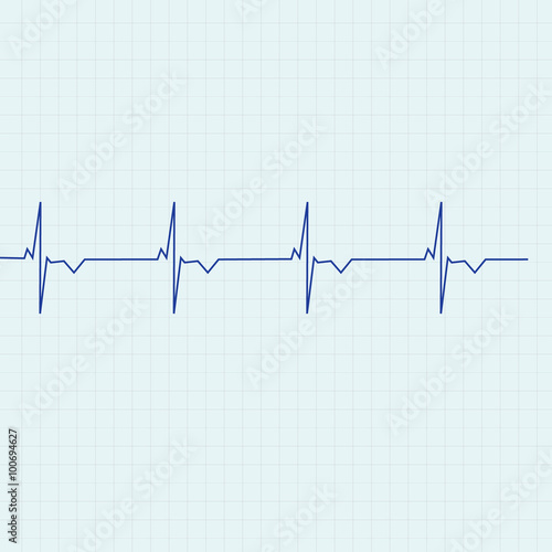 Ekg line