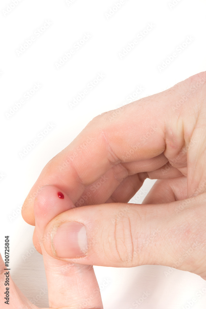 Blood Prick For Sugar Levels