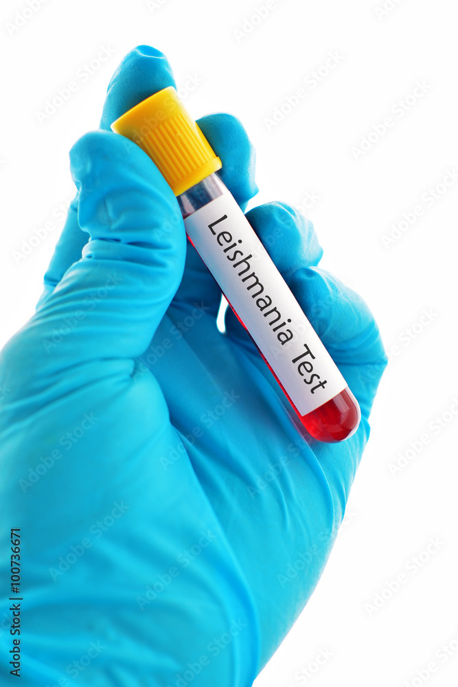 Obraz premium Blood sample for Leishmania parasite test