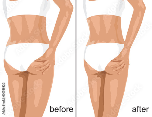 Before and after