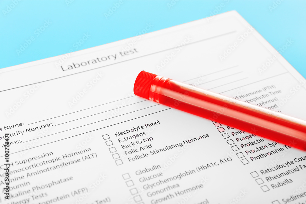 Blood in test tubes and investigation form on the table Blood in test tubes and investigation form on the table