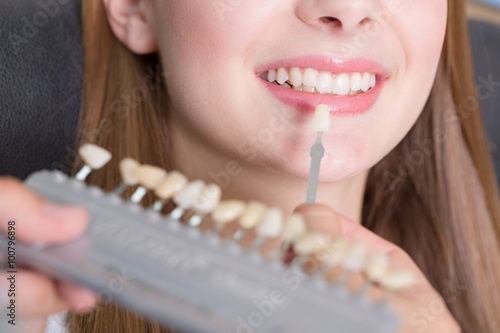 Beim Zahnarzt - Zahnfarbe für eine Krone mit einem Frabring vergleichen