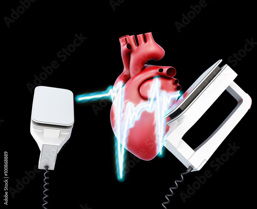 Defibrillator and heart on a black background. 3d illustration