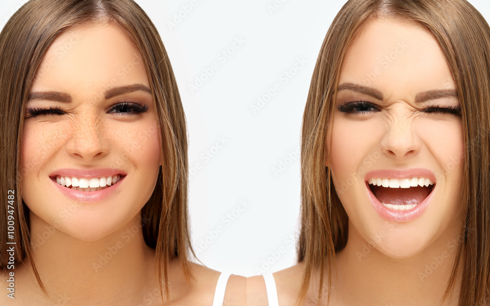 Freckles. Model's face divided in two parts Freckles. Model's face divided in two parts