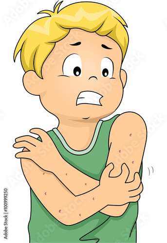 Itching Boy