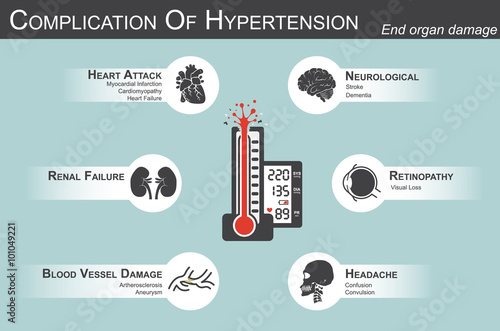 Complication of Hypertension(Heart attack : myocardial infarction , cardiomyopathy )(Brain : stroke , dementia )( visual loss )(Headache)(Renal failure)( Artherosclerosis , aneurysm ) end organ damage