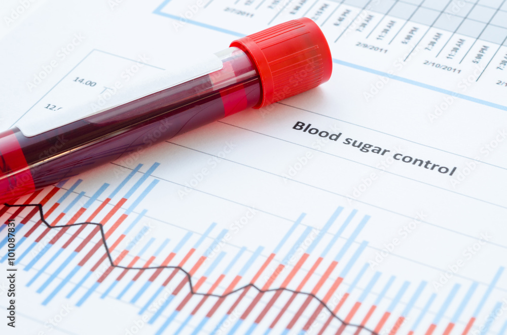 Sample blood for screening diabetic test. Sample blood for screening diabetic test.
