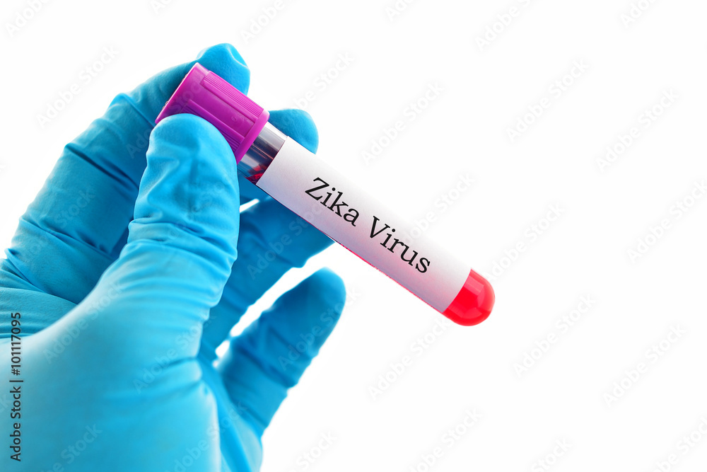 Obraz premium Blood sample positive with Zika virus