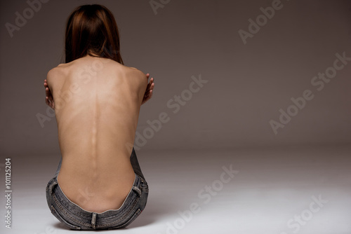 Tableau sur toile Thin girl back