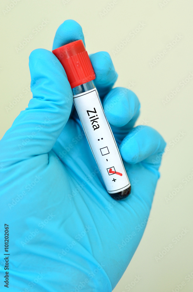Obraz premium Blood sample positive with Zika virus 