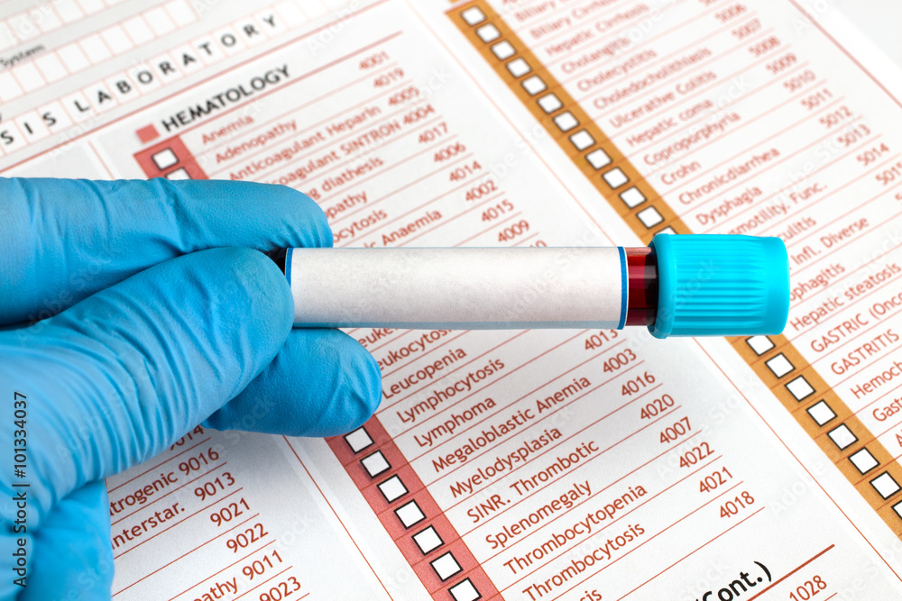 Φωτογραφία hand holding Blood tests over medical report /hand holding a tube labeled in whi