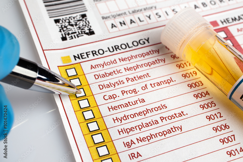 Φωτογραφία physician filling medical form of urianalysis / Doctor writing a report of analy